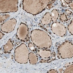 C14orf93 Antibody, Novus Biologicals:Antibodies:Primary Antibodies
